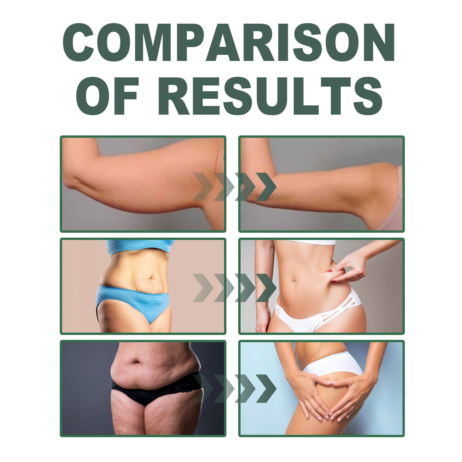 Pregnancy-Safe Collagen Firming Body Oil for Stretch Marks & Loose Skin